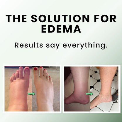 SilvaraSkin™ Miracle Balm