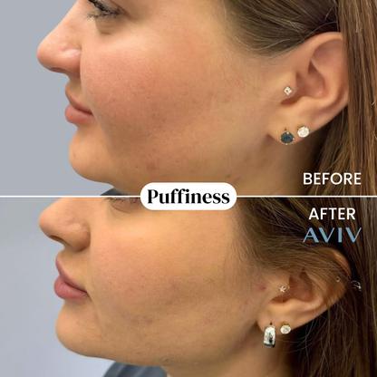 Organic Lymphatic Drainage Drops