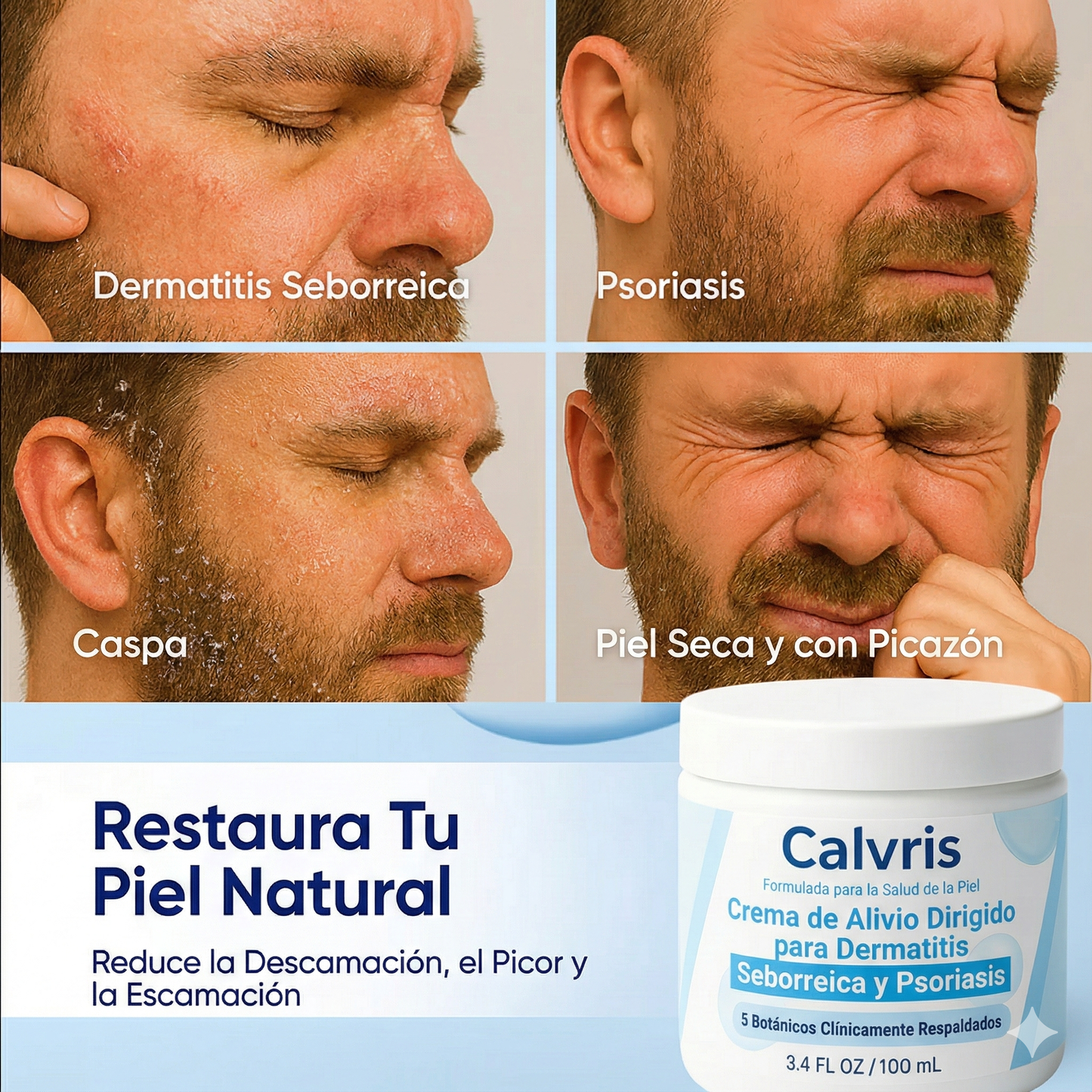 Crema para dermatitis seborreica y psoriasis